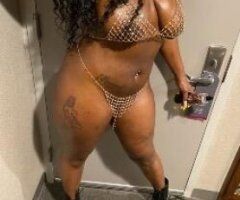 Queens escorts - its candy baby hi guys 🇯🇲im jamaican an im loads of fun🌹💄🌸🍒