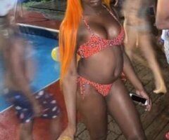 Albany escorts - Your post op fantasy Pretty chocolate 😘