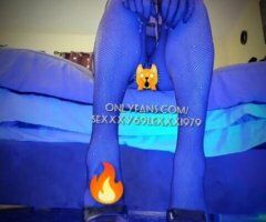 Fort Myers escorts - 🎲🅦🅗🅨 🅖🅐🅜🅑🅛🅔❓🤨🎲ᗯᕼEᑎ I'ᗰ TᕼE ᒍᗩᑕKᑭOT🏆🎰🎯🥇🎰💋
