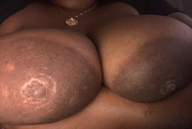 💦💦🍒🍉 Juicy Melons 🍉🍒💦💦 ~ SPECIALS ON INCALL ONLY~ - 1