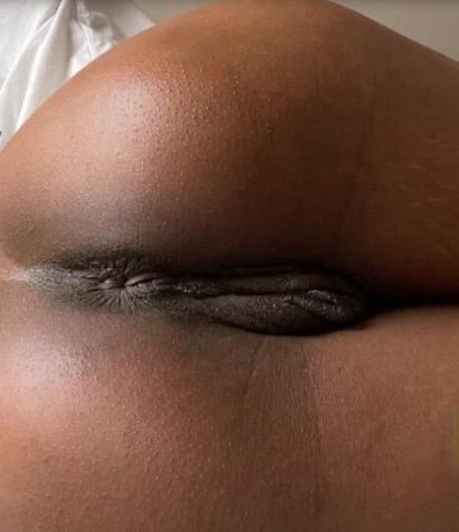 SlimmGoodie - 1