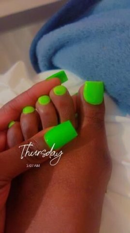 ROYAL TREATMENT - 1