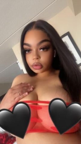 Exotixx 😍 - 1