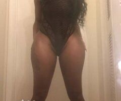 St. Louis escorts - 💯hundred dollars special 🛑incall 🛑outcalls 💋sensual massage🛑🛑outcalls