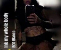 hit me up serious injuries only - 28 - Image 2