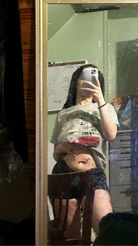 🩷🤍🩷🤍🩷INCALL WITH A BABE WITH VITILIGO 🤍🩷🤍🩷🤍🩷 - 23 - 1