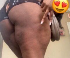 Rochester escorts - 🍒INCALL HHR SPECIAL 🍒 SWEET & ADDICITIVE BBJ SPECIALS GOING ON 24\7 - 21
