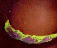 OUTCALLS - 24 - Image 2