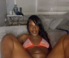 Troat🍆Doctor In/Outcalls in Chicago, IL — Open 24/7 — 22 - Image 4