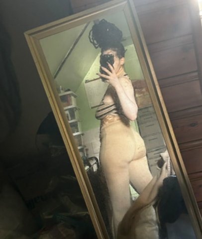 Long Island Vitiligo Babe — Incalls, Outcalls & CarPlay 24/7 - 1