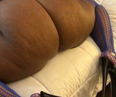 Denver CO Outcalls — Cash Only - Image 3