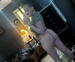 Long Island escorts - Vitiligo Babe — Incalls, Outcalls & CarPlay