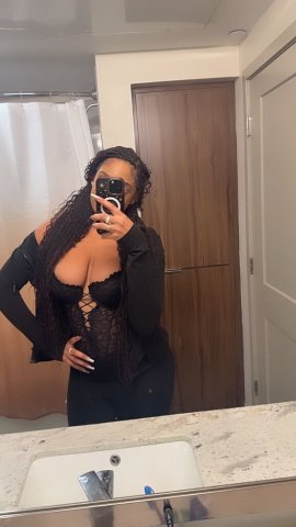 Boston, MA Female Escort — Natural beauty, vitiligo (outcalls) - 1