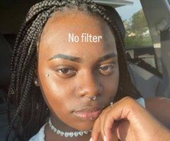 Miami, FL Brace Face Baby — Pay-to-Play Full DSL - Image 2