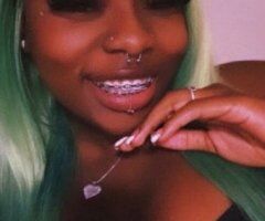 Miami, FL Brace Face Baby — Pay-to-Play Full DSL - Image 4