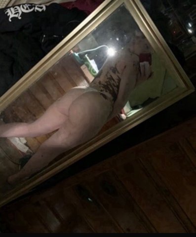 Long Island Vitiligo Babe — Outcalls, Incall & CarPlay (24/7) - 1