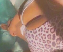 North Miami Beach Incall Deals by I-95 & 826 (Ends 11AM) - Image 2