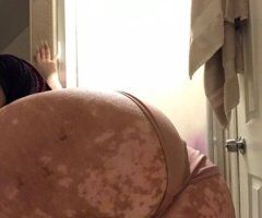 Brooklyn Vitiligo Babe Incalls - Image 3