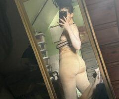 Long Island Vitiligo Babe Incalls & CarPlay - Image 3