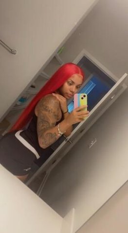 ❤IM AVAILABLE❤ 24/7 HR ❤ EXOTIC 🔥CALL OR TEXT ME❤‍🔥📞 - 24 - 1
